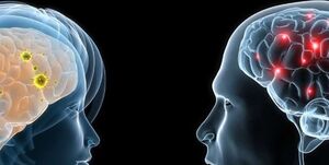 عکس خبري -آيا مغز مردان از زنان بزرگتر است؟