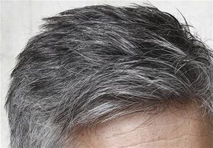 عکس خبري -چند راهکار ساده براي ديرتر سفيد شدن موهاي سر