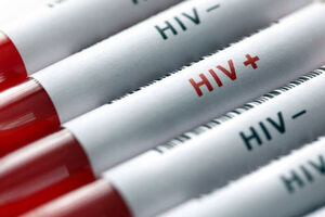 عکس خبري -انجام بيش از ??? هزار تست تشخيص ايدز در کشور