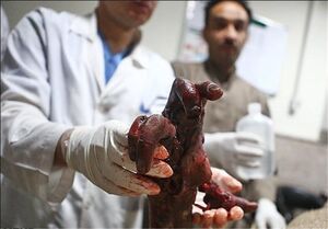 عکس خبري -ساخت ترقه و قطع دستان نوجوان شيرازي