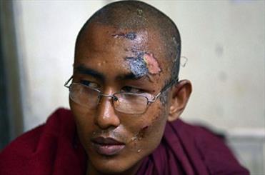 عکس خبري -افشاي جنايتي ديگر در برمه