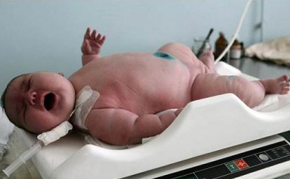 عکس خبري -عکس/ سنگين وزن ترين نوزاد جهان