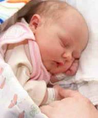 عکس خبري -تولد نوزادي که خون ندارد!