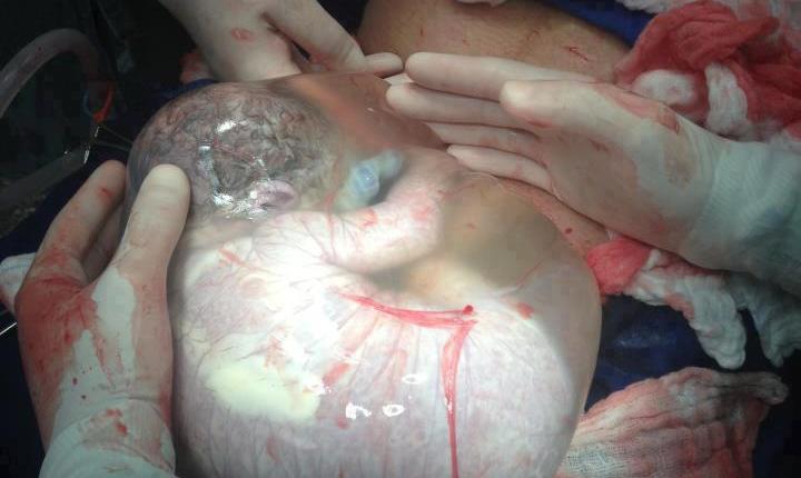 عکس خبري -عکسي شگفت آور از تولد يک نوزاد