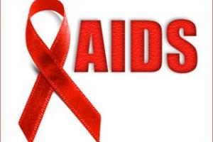 عکس خبري -علائم ابتلا به HIV ايدز چيست؟