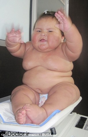 عکس خبري -نوزادي با غير طبيعي ترين رشد وزن+عکس