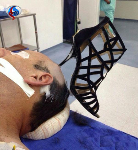 عکس خبري -پاشنه کفش زن در سر شوهر جا ماند! +عکس