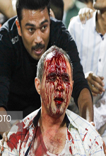 عکس خبري -گزارش تصويري/حواشي خونين ديدار استقلال خوزستان و پرسپوليس 