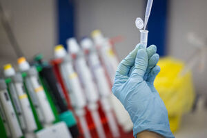 عکس خبري -واکسن ايراني کرونا در مرحله مطالعات حيواني