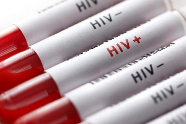 عکس خبري - براي انجام "تست رايگان HIV" به کجا مراجعه کنيم؟!
