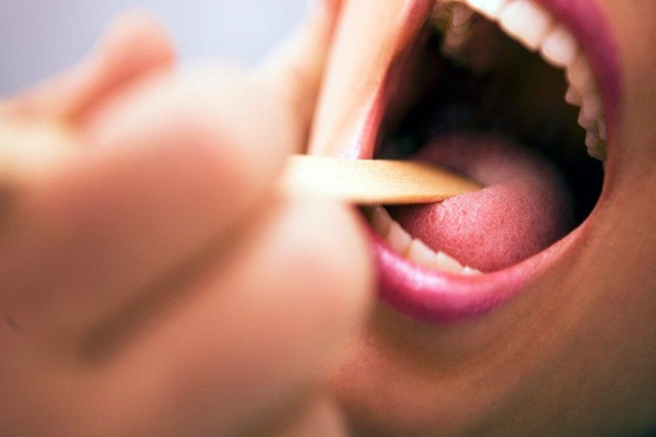عکس خبري - علائم ? بيماري، اولين بار در دهان ظاهر مي شود!