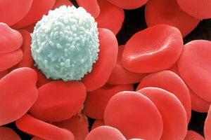 عکس خبري -علائم سرطان خون را بشناسيم