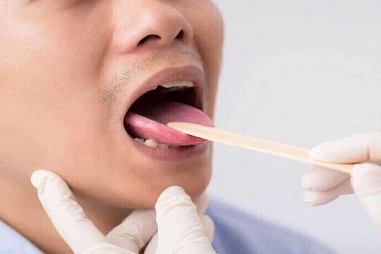 عکس خبري - دو علامت در دهان که نشان از سطح بالاي قند خون دارد