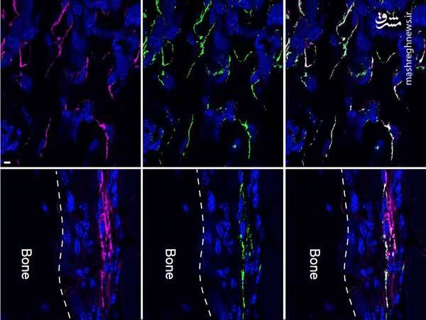 عکس خبري -کشف پروتئيني براي درمان پوکي استخوان