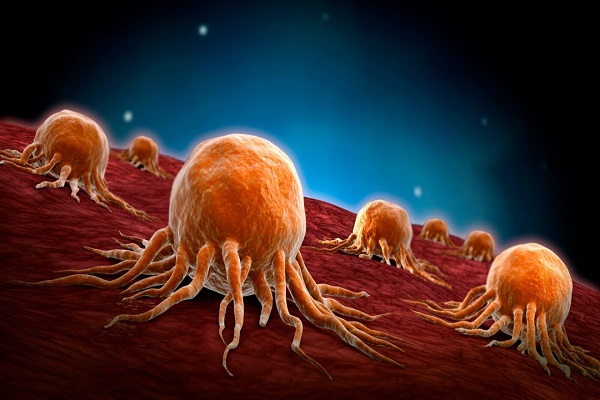 عکس خبري - کشف راهي جديد براي مبارزه با سلول‌هاي سرطاني بدخيم