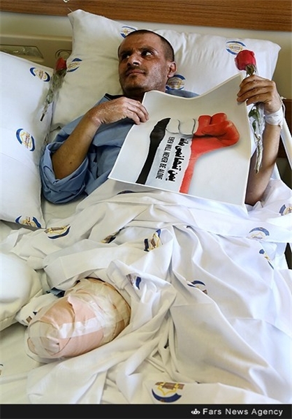 عکس خبري - درخواست مجروحان يمني از ملت عربستان